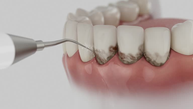 Reliable Dental Implants contractor in Winfield, TN by Smile Center Dentistry
